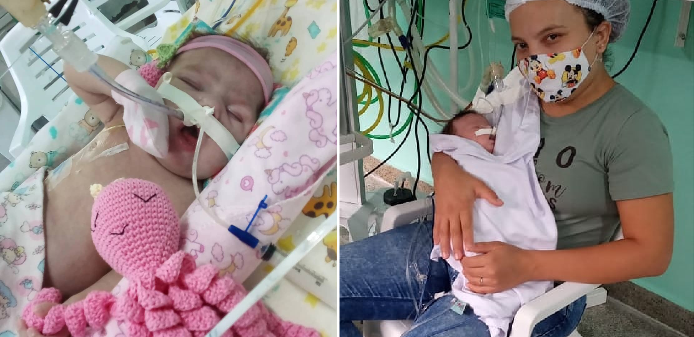Bebê que vivia na UTI morre após 4 meses